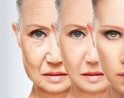 Contraindikatiounen op Laser Rejuvenation